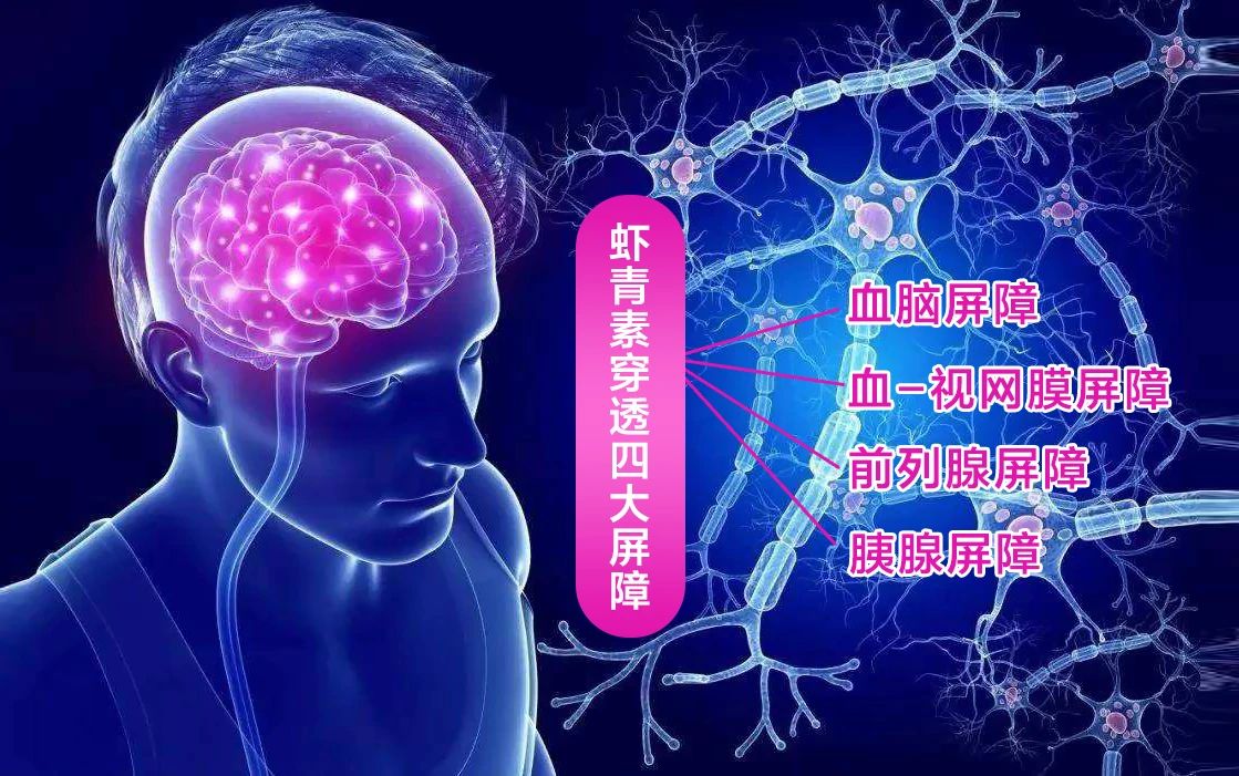 艾诗特3499拉斯维加斯