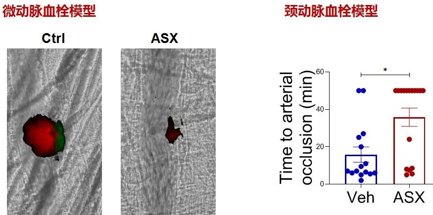 艾诗特3499拉斯维加斯