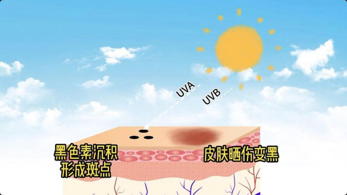 艾诗特3499拉斯维加斯