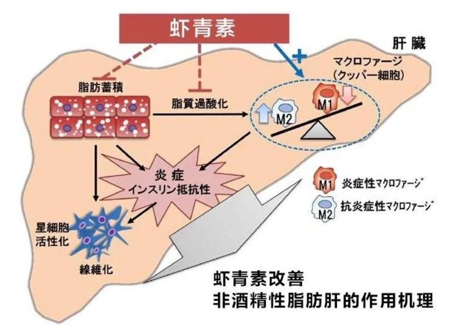 艾诗特3499拉斯维加斯