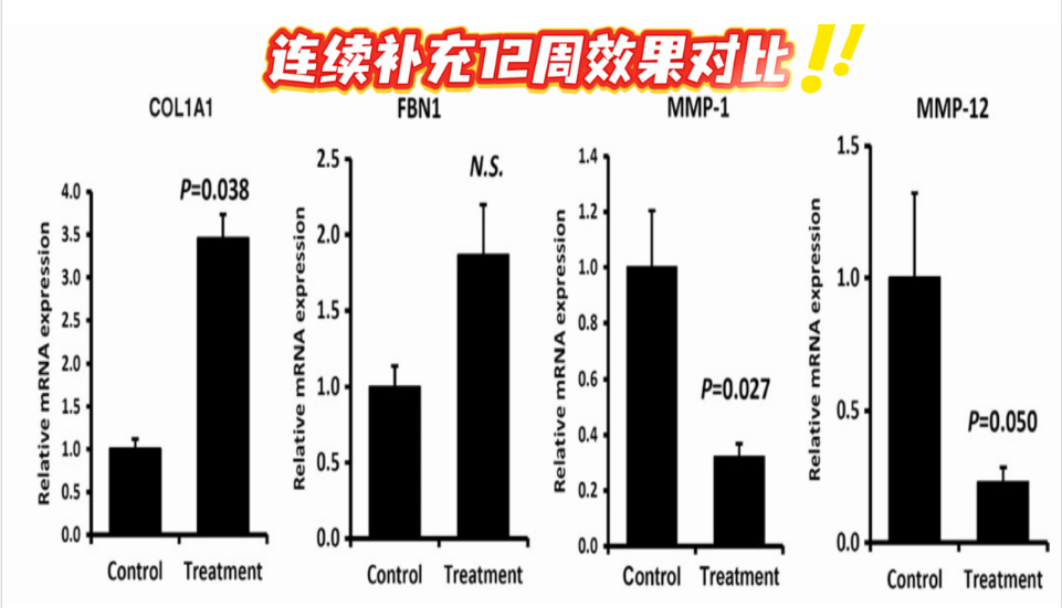 艾诗特3499拉斯维加斯