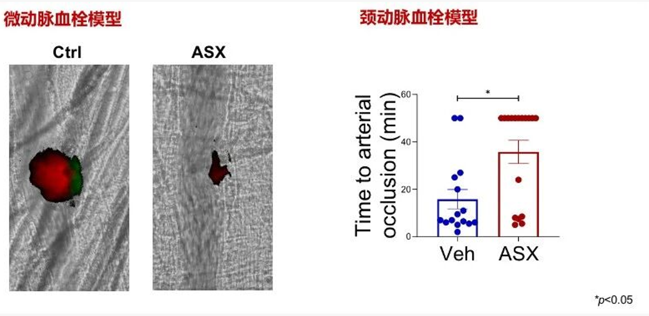 艾诗特3499拉斯维加斯