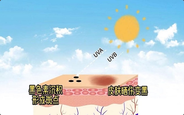 天然3499拉斯维加斯能够祛斑吗？